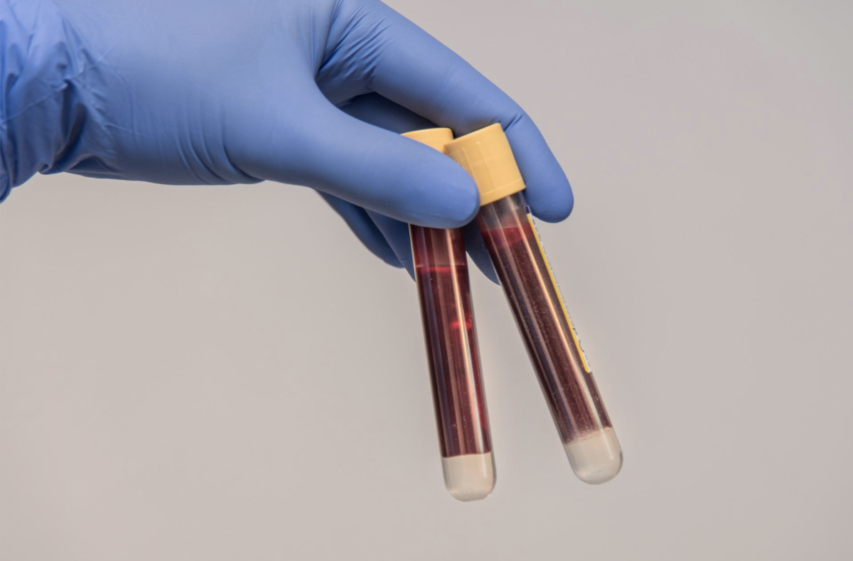 Explosive Corona-Impf-Studie – Palmer und Bhakdi: „unwiderlegbaren Beweis“ mRNA-Ipfung schädigt Gefäße und Organe und bleibt aktiv!