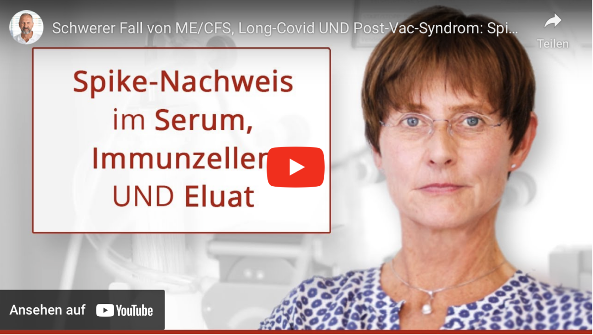 Schwerer Fall von ME/CFS, Long-Covid UND Post-Vac-Syndrom: Spike im Serum und Immunzellen mit Labor