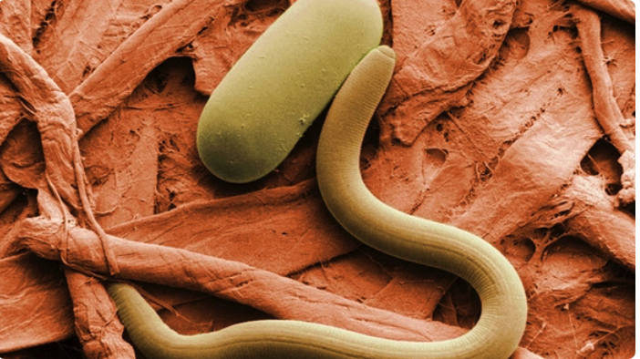 Parasiten, Umweltgifte und die stille Gesundheitskrise, die Amerika erfasst