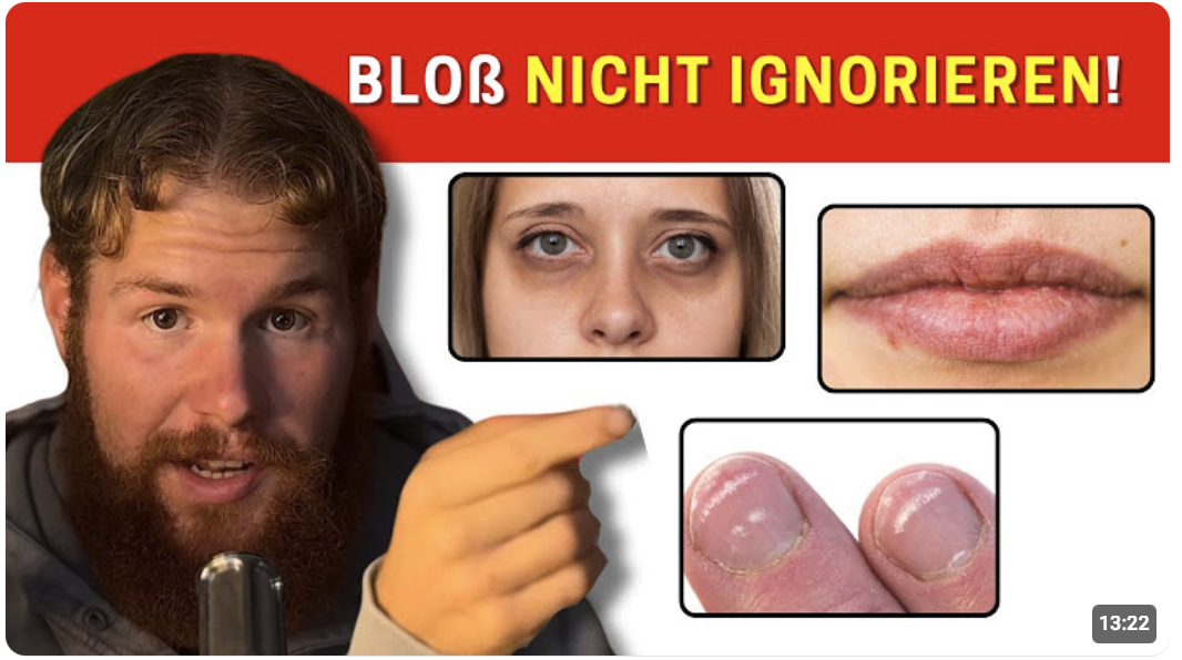 23 Komische Anzeichen dass dein Körper Nährstoffmängel hat