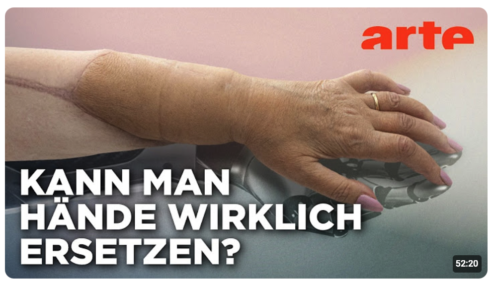 Die neue Hand – Geschichte einer Transplantation | Doku HD | ARTE